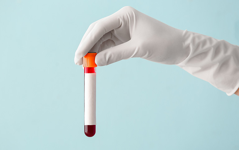 Immunology Banner Mobile - Brellah