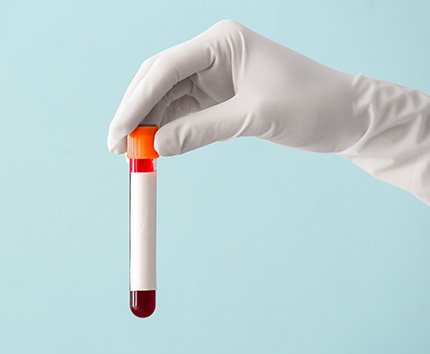 Immunology Banner Thumbnail - Brellah